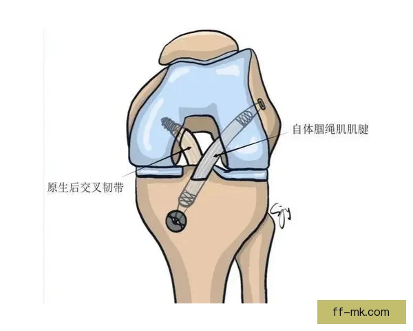 科尔十字韧带断裂后的艰难康复之路全纪录